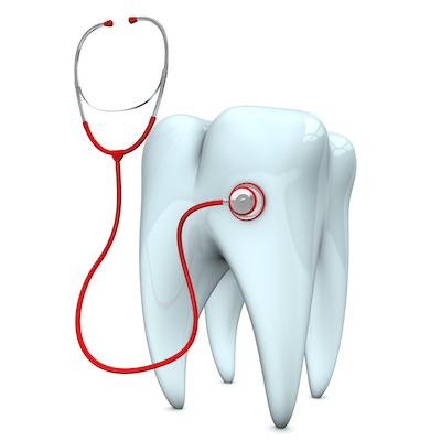 image of a tooth in bonita springs