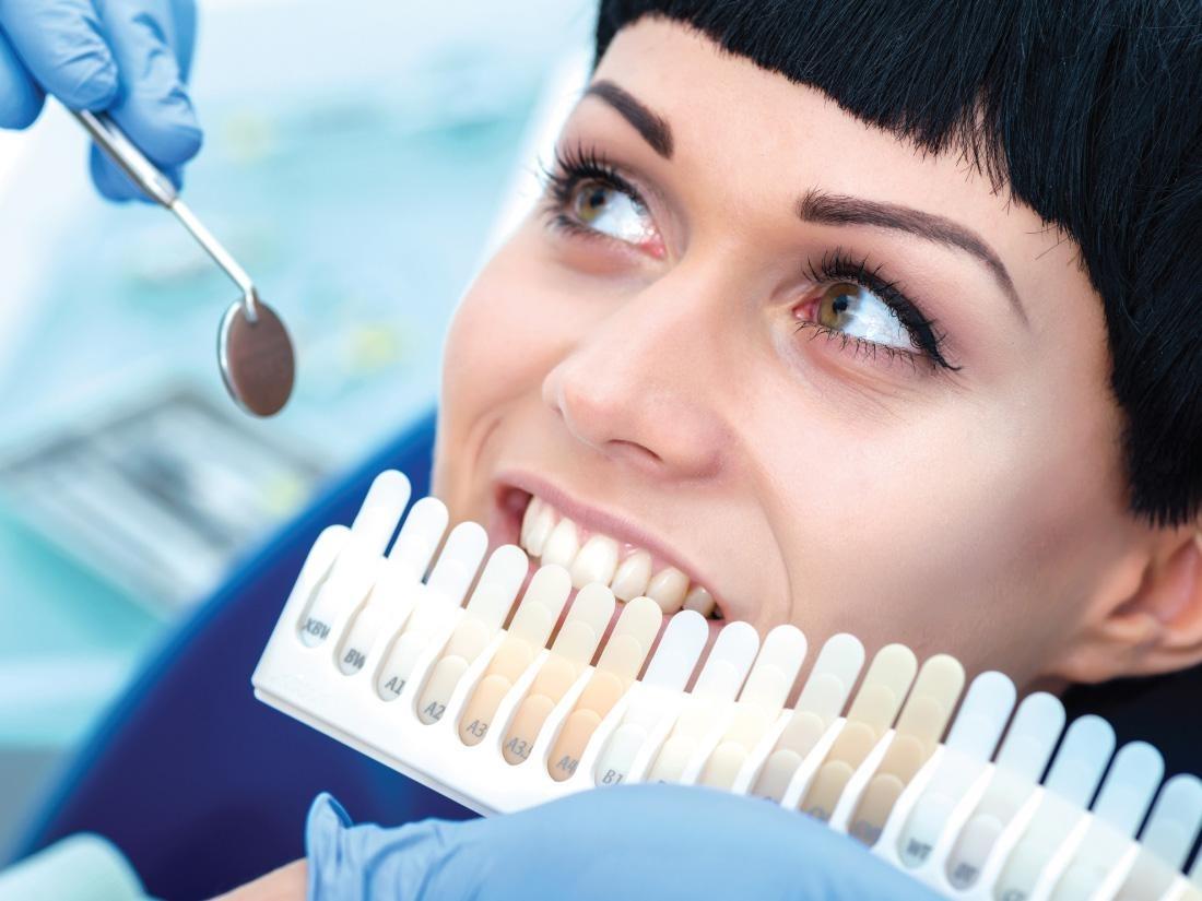 Myths About Teeth Whitening 34135 Blog Bonita Springs Dentist