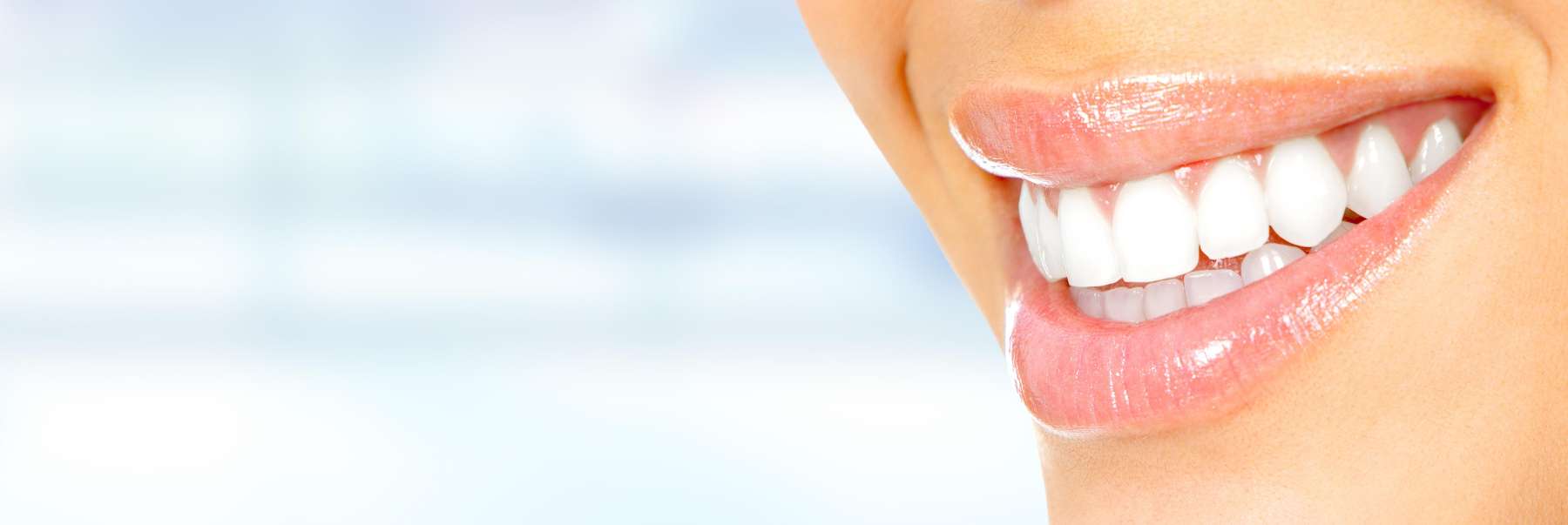 woman smiling after getting her teeth whitened in bonita springs