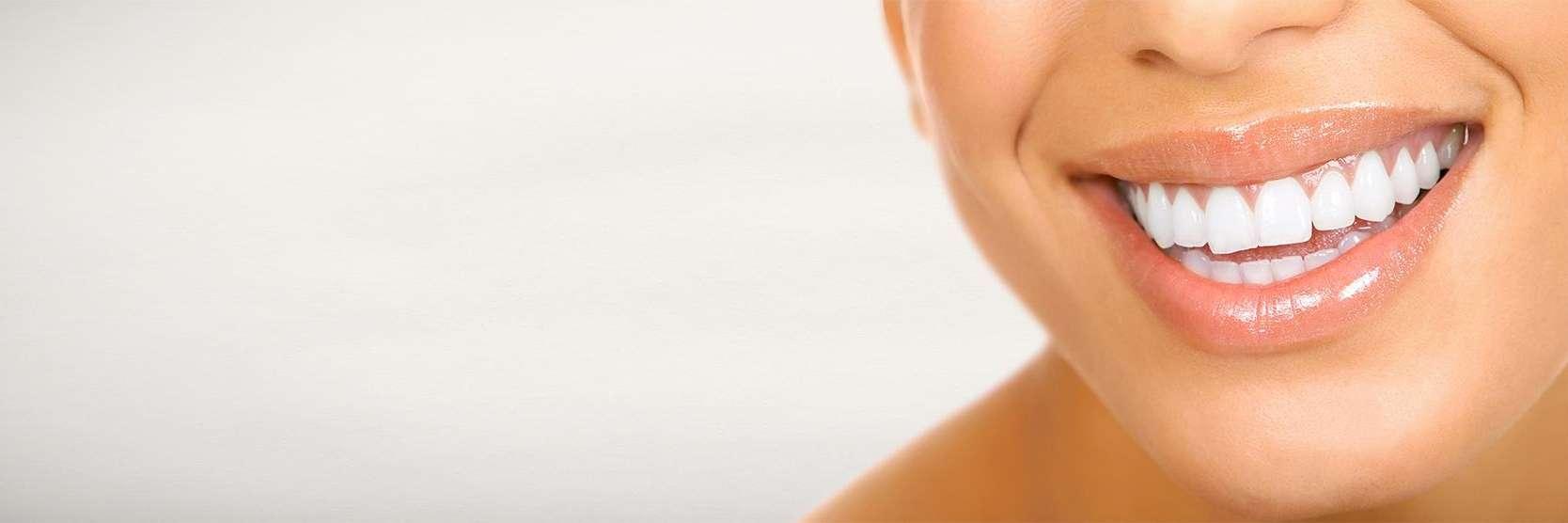 woman with a bright white smile in bonita springs